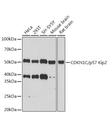 CDKN1C/p57 Kip2 Rabbit Monoclonal Antibody