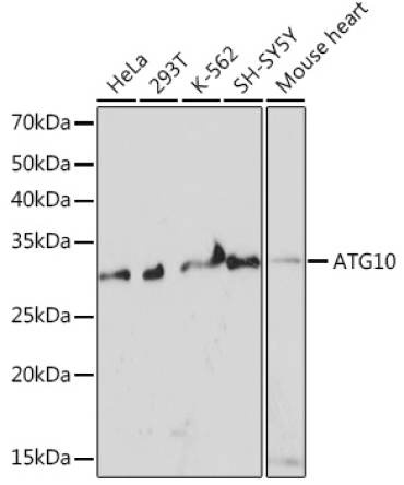 ATG10 Rabbit Monoclonal Antibody