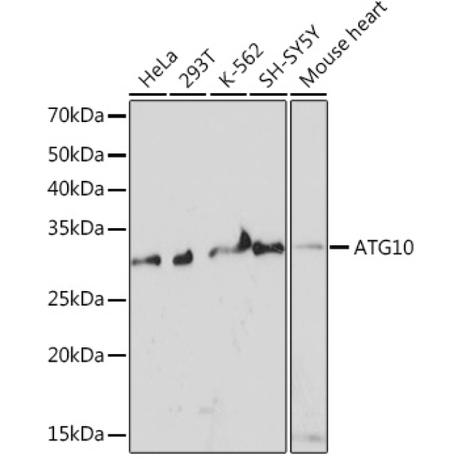 ATG10 Rabbit Monoclonal Antibody