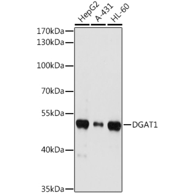 DGAT1 Rabbit Polyclonal Antibody