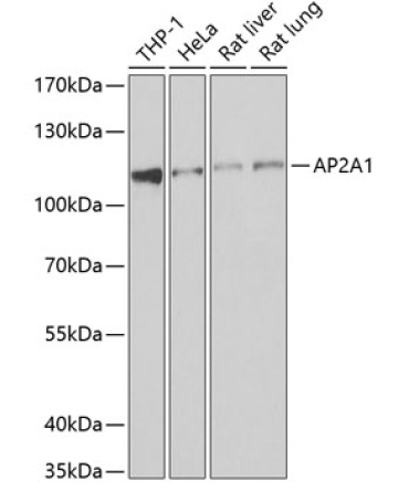 AP2A1 Rabbit Polyclonal Antibody