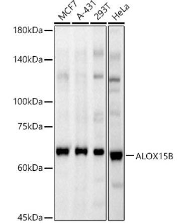 ALOX15B Rabbit Polyclonal Antibody