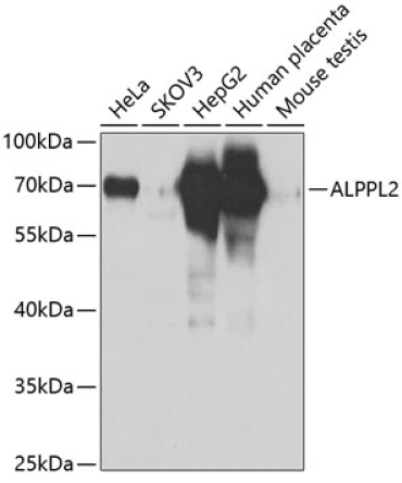 ALPPL2 Rabbit Polyclonal Antibody