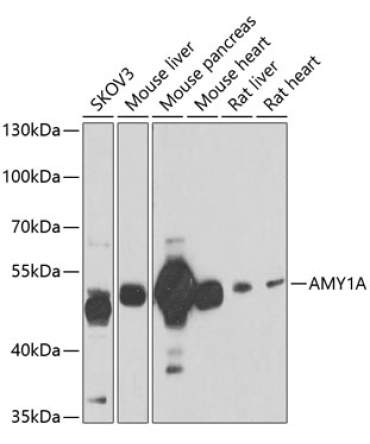 AMY1A Rabbit Polyclonal Antibody