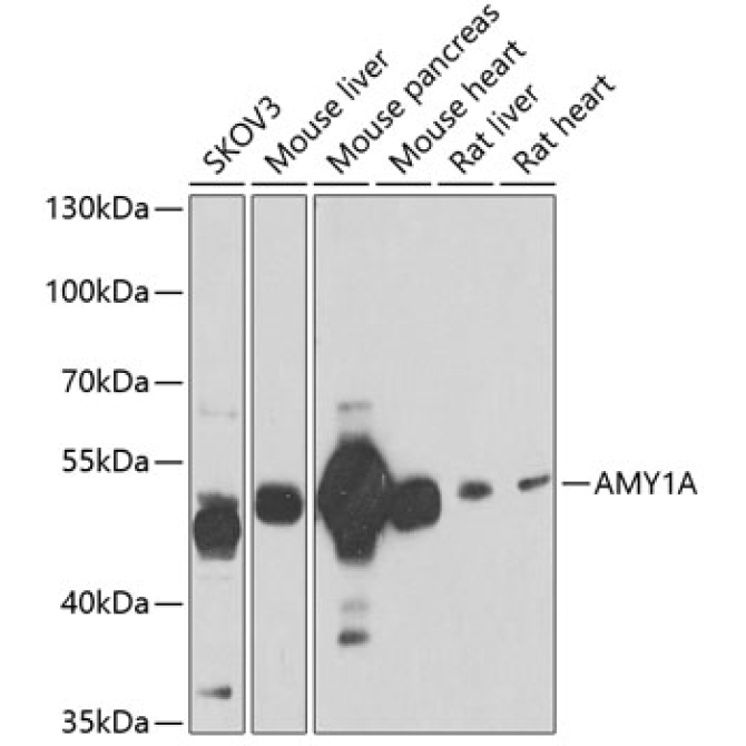 AMY1A Rabbit Polyclonal Antibody
