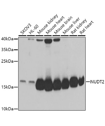 NUDT2 Rabbit Polyclonal Antibody