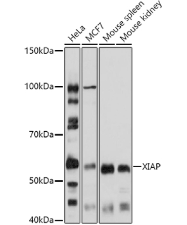 XIAP Rabbit Polyclonal Antibody [KO Validated]