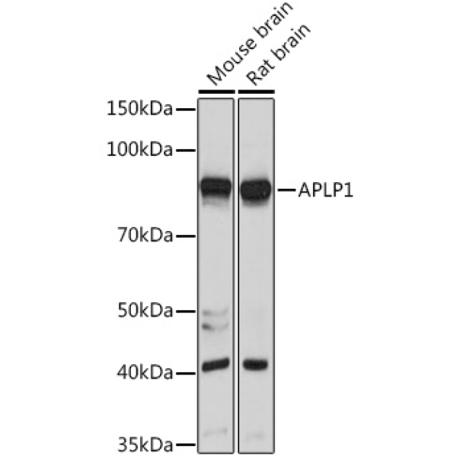 APLP1 Rabbit Polyclonal Antibody