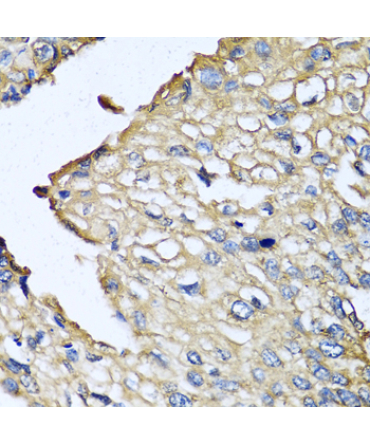 ASIP Rabbit Polyclonal Antibody