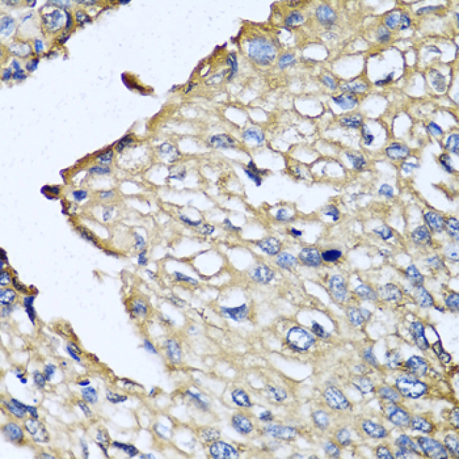 ASIP Rabbit Polyclonal Antibody