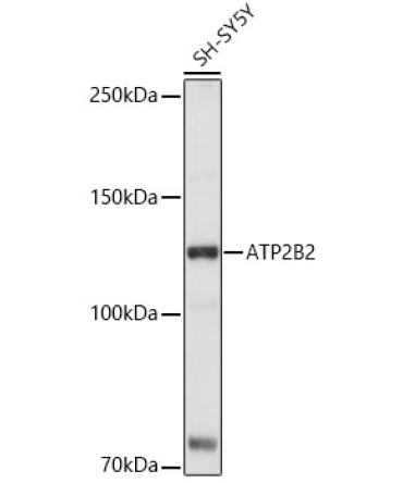 ATP2B2 Rabbit Polyclonal Antibody