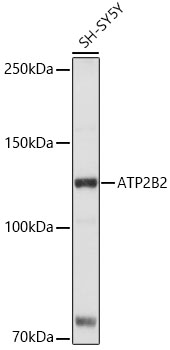 ATP2B2 Rabbit Polyclonal Antibody