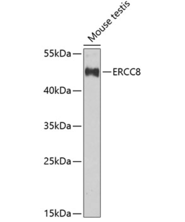 ERCC8 Rabbit Polyclonal Antibody