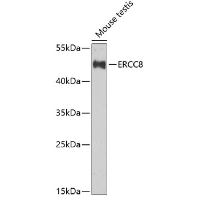 ERCC8 Rabbit Polyclonal Antibody