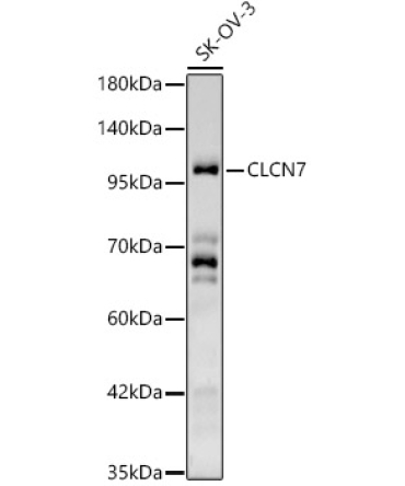 CLCN7 Rabbit Polyclonal Antibody