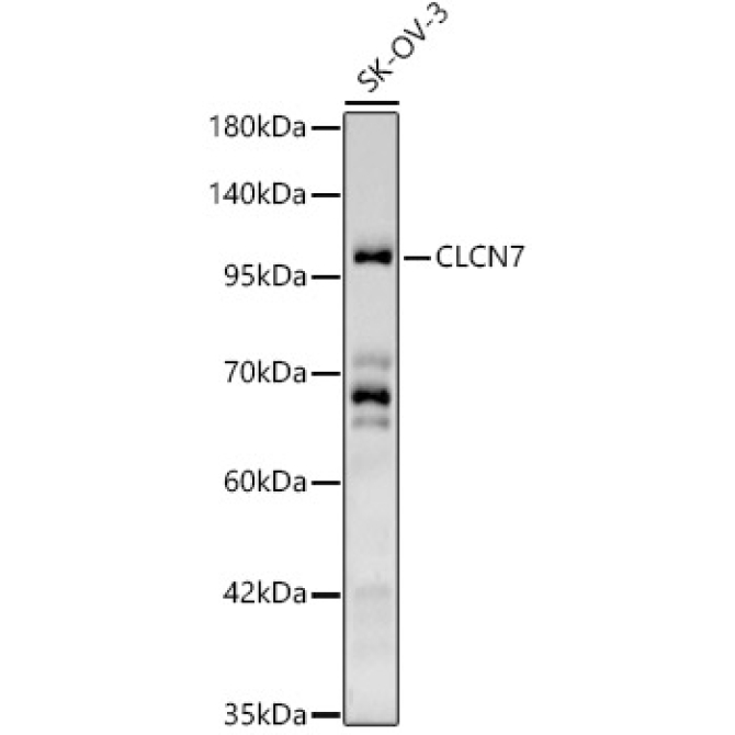 CLCN7 Rabbit Polyclonal Antibody