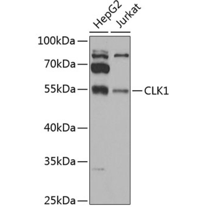 CLK1 Rabbit Polyclonal Antibody