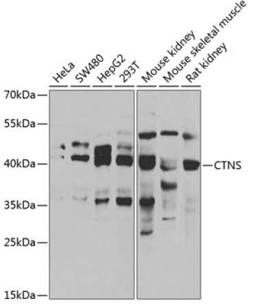 CTNS Rabbit Polyclonal Antibody