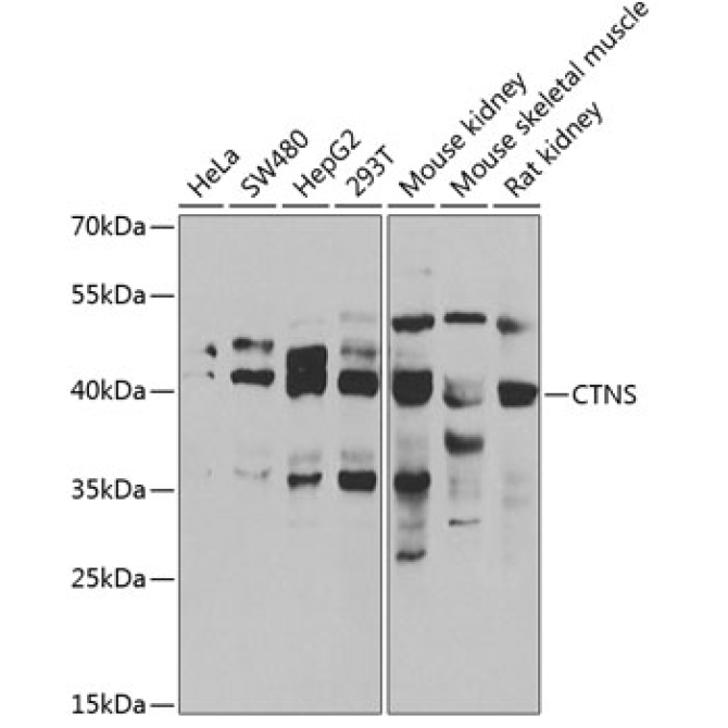 CTNS Rabbit Polyclonal Antibody