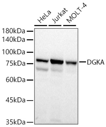 DGKA Rabbit Polyclonal Antibody