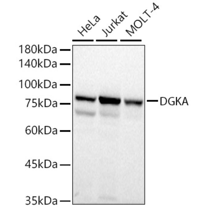 DGKA Rabbit Polyclonal Antibody