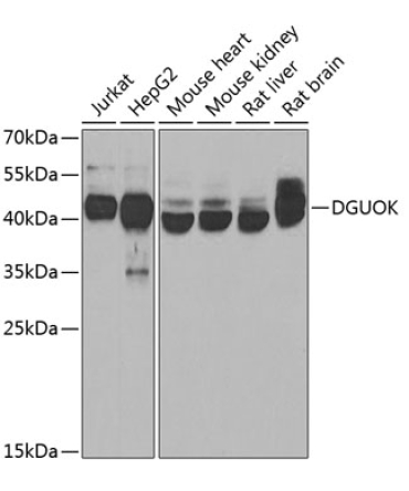 DGUOK Rabbit Polyclonal Antibody