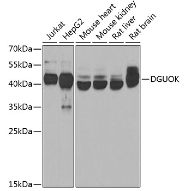 DGUOK Rabbit Polyclonal Antibody