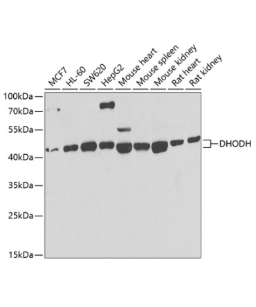 DHODH Rabbit Polyclonal Antibody