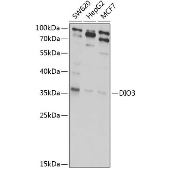 DIO3 Rabbit Polyclonal Antibody