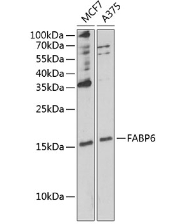 FABP6 Rabbit Polyclonal Antibody