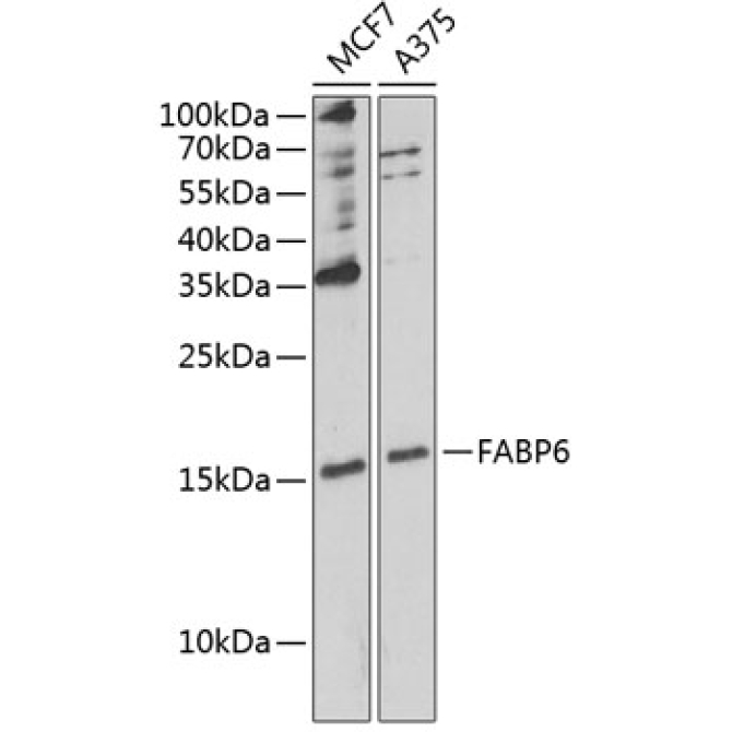 FABP6 Rabbit Polyclonal Antibody