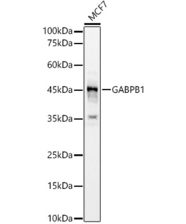 GABPB1 Rabbit Polyclonal Antibody