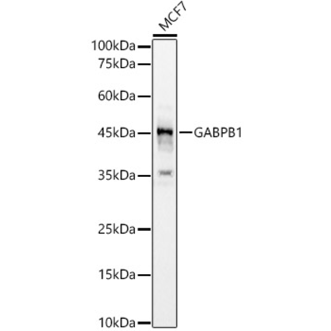 GABPB1 Rabbit Polyclonal Antibody