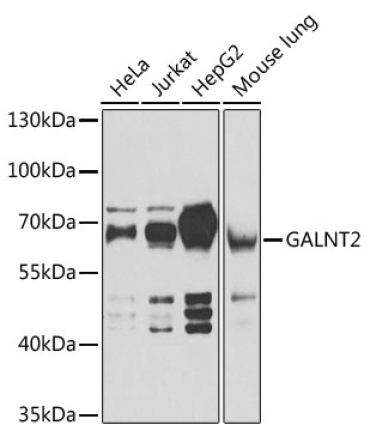 GALNT2 Rabbit Polyclonal Antibody