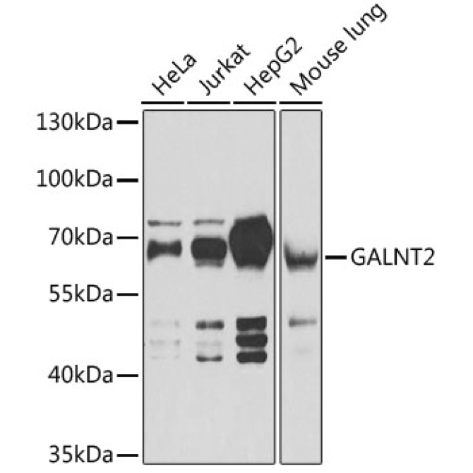GALNT2 Rabbit Polyclonal Antibody