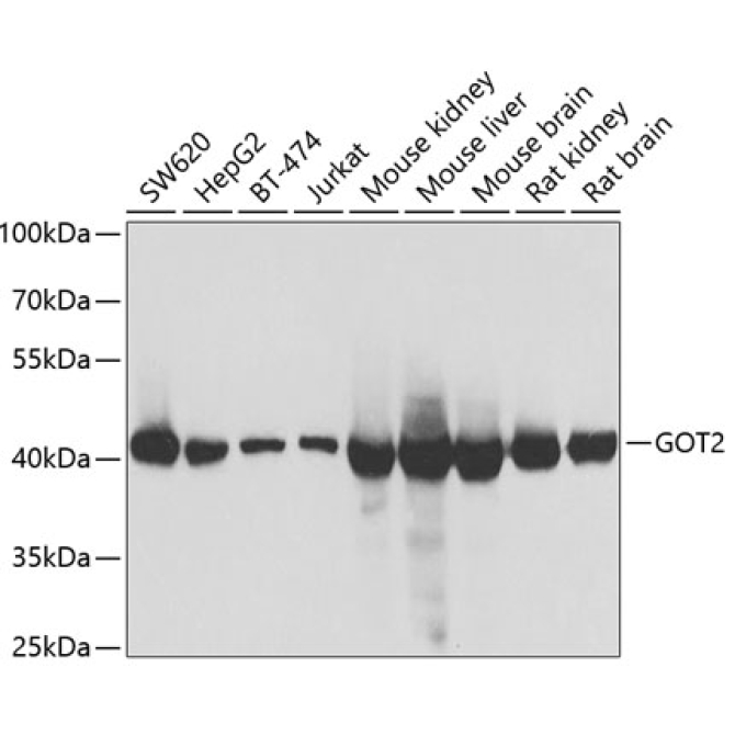 GOT2 Rabbit Polyclonal Antibody