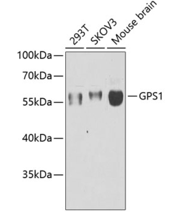 GPS1 Rabbit Polyclonal Antibody