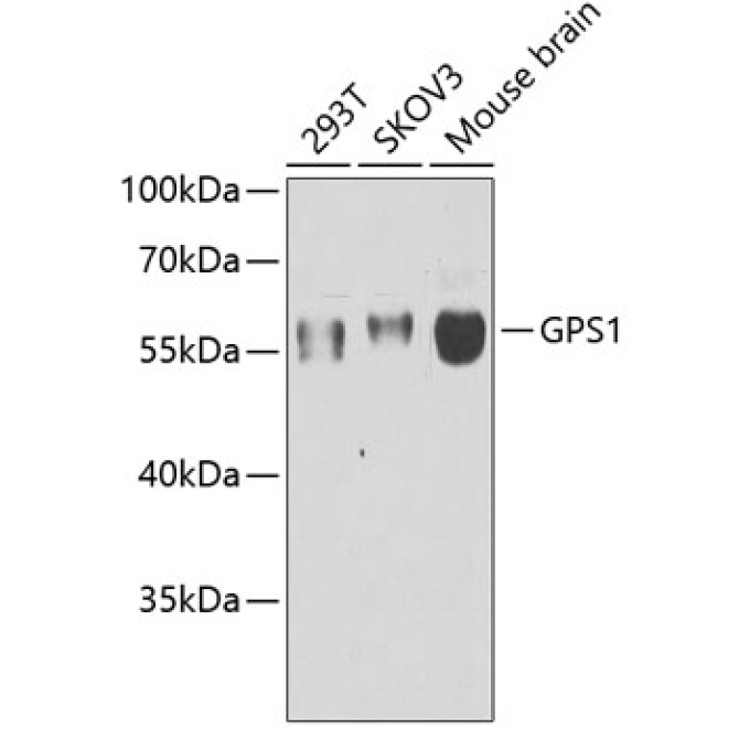 GPS1 Rabbit Polyclonal Antibody