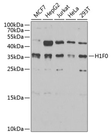 Histone H1.0 Rabbit Polyclonal Antibody