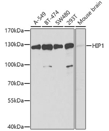 HIP1 Rabbit Polyclonal Antibody