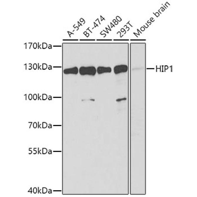 HIP1 Rabbit Polyclonal Antibody