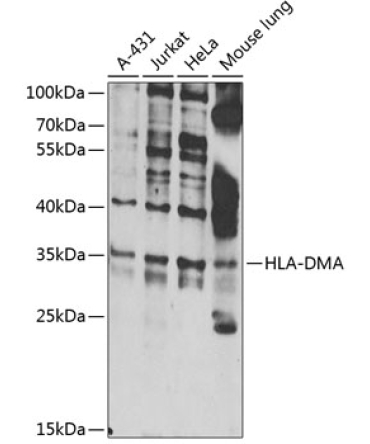 HLA-DMA Rabbit Polyclonal Antibody
