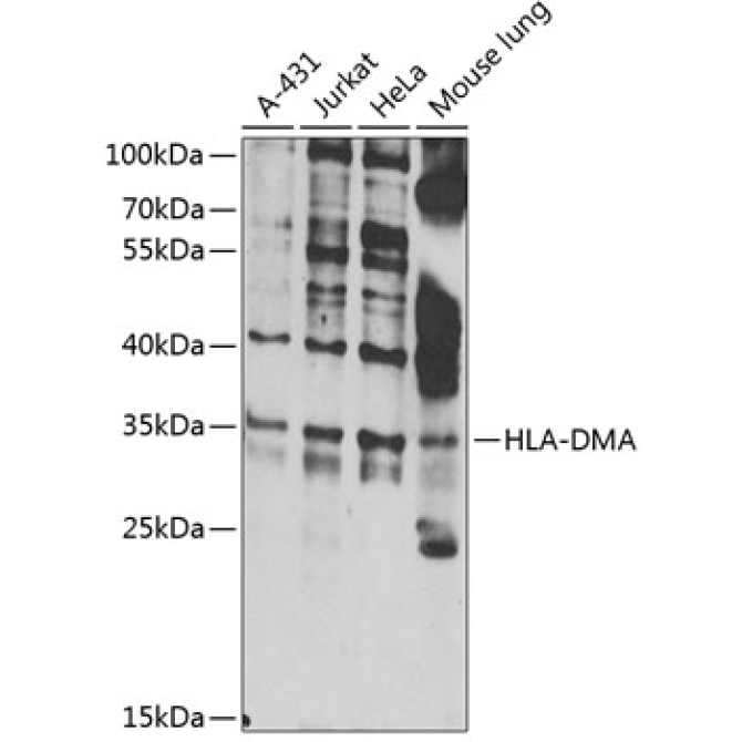 HLA-DMA Rabbit Polyclonal Antibody