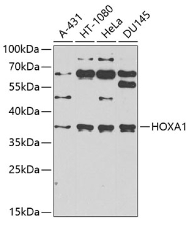 HOXA1 Rabbit Polyclonal Antibody