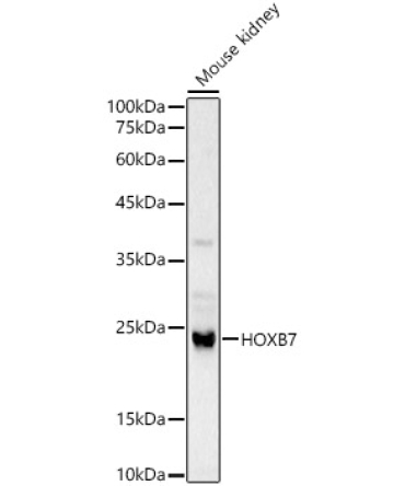 HOXB7 Rabbit Polyclonal Antibody