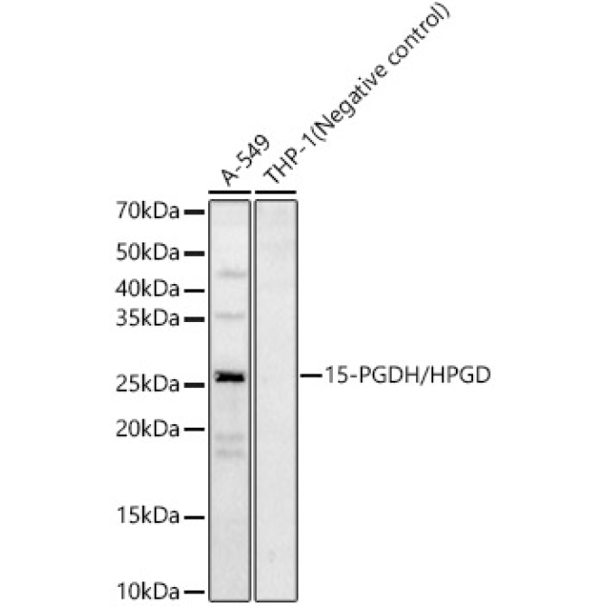 15-PGDH/HPGD Rabbit Polyclonal Antibody
