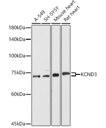 KCND3 Rabbit Polyclonal Antibody