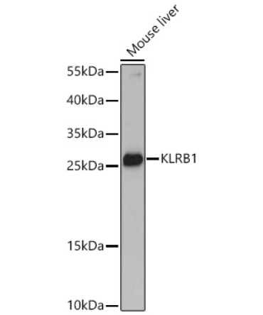 KLRB1 Rabbit Polyclonal Antibody
