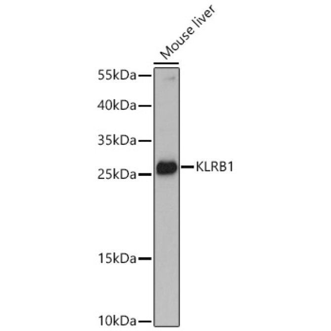 KLRB1 Rabbit Polyclonal Antibody