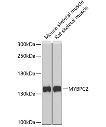 MYBPC2 Rabbit Polyclonal Antibody